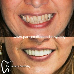 We are the best cosmetic dentistry in Parramatta.