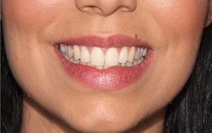 We are the best dentistry in Parramatta.