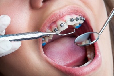 We have the best Orthodontist here in Parramatta.