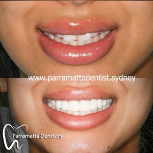 We are the best dentistry in Parramatta.