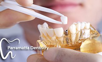 Dental Implant Parramatta We have the best special offers in Parramatta.
