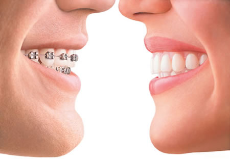 We have the best Orthodontics in Parramatta.