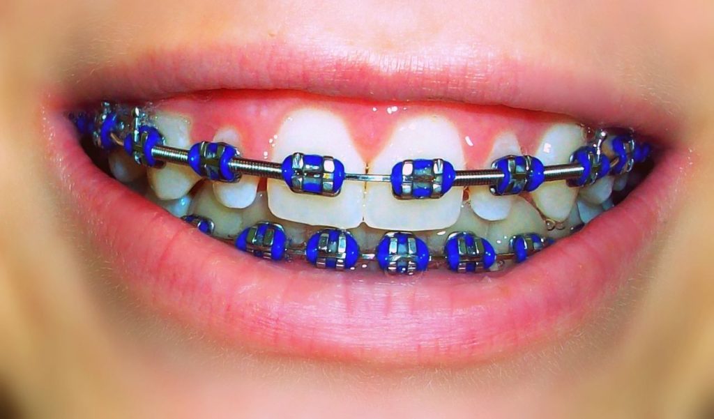 Orthodontist In Parramatta