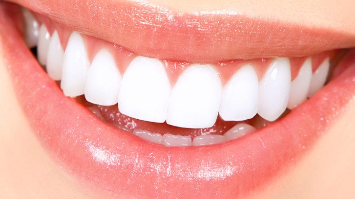 We are the best dentistry for teeth whitening in Parramatta.