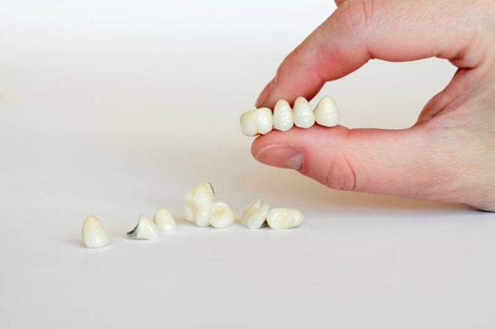 Dental Crowns Near Me | We have the best dental crowns in Parramatta.