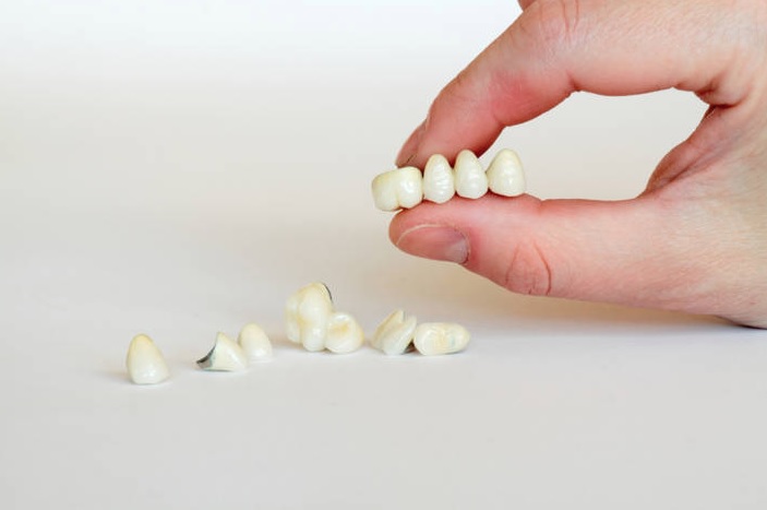 We have the best dental crowns in Parramatta.