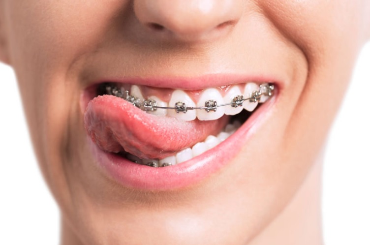 We have the best orthodontist in Parramatta.