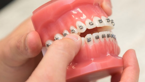 Parramatta Orthodontist