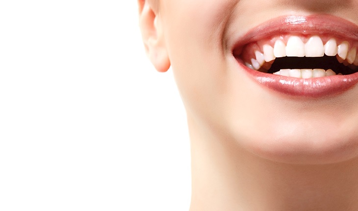 The best teeth whitening in Parramatta.