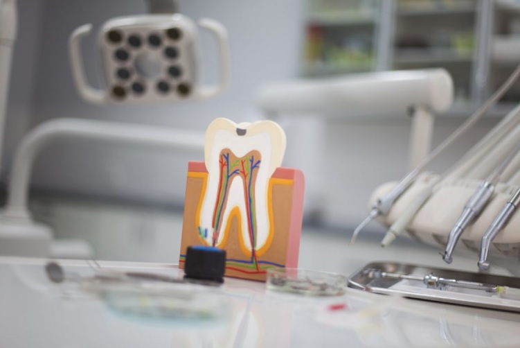 We have affordable root canal therapy in Parramatta