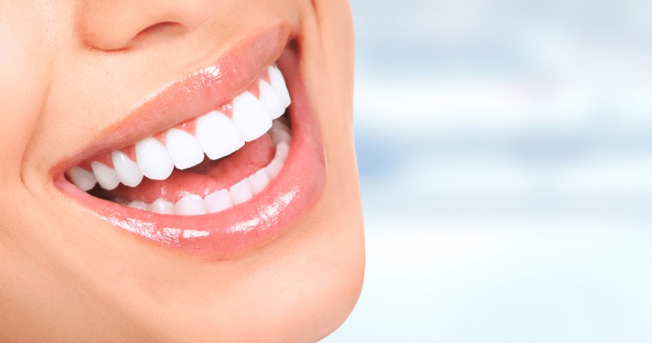 We have affordable teeth whitening in Parramatta.