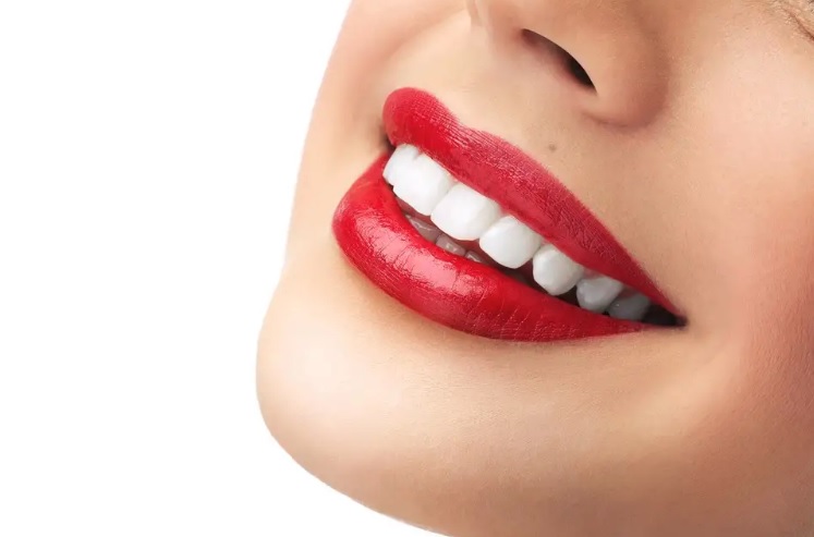 The best teeth whitening in Parramatta.