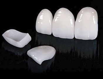 Porcelain Veneers in Parramatta