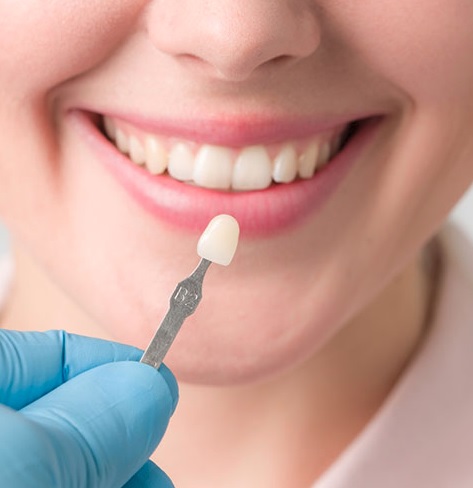 Dental Veneers Cost in Parramatta