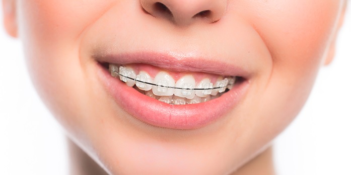 Orthodontics in Parramatta