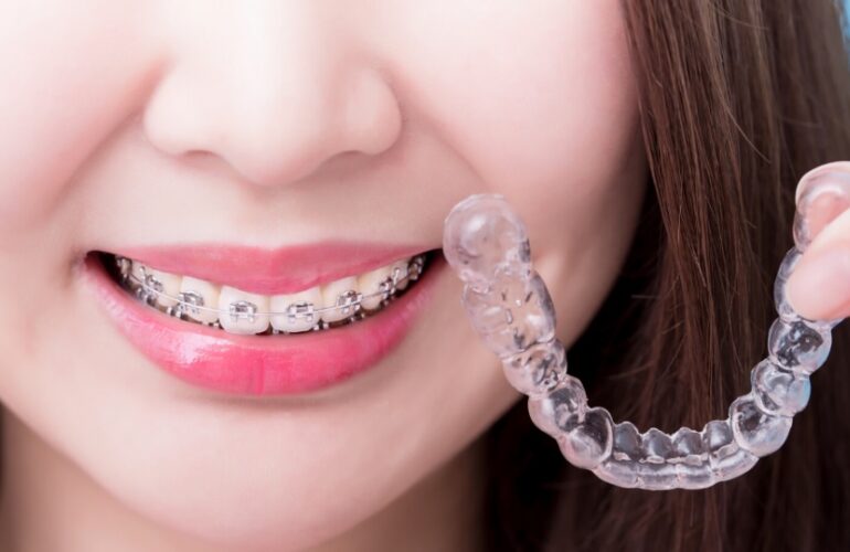 best orthodontist parramatta