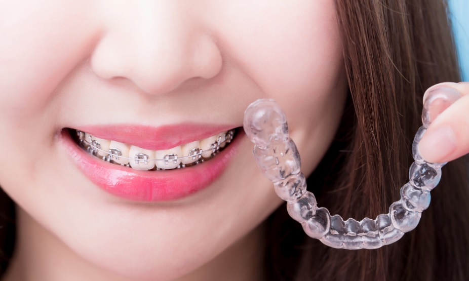 best orthodontist parramatta