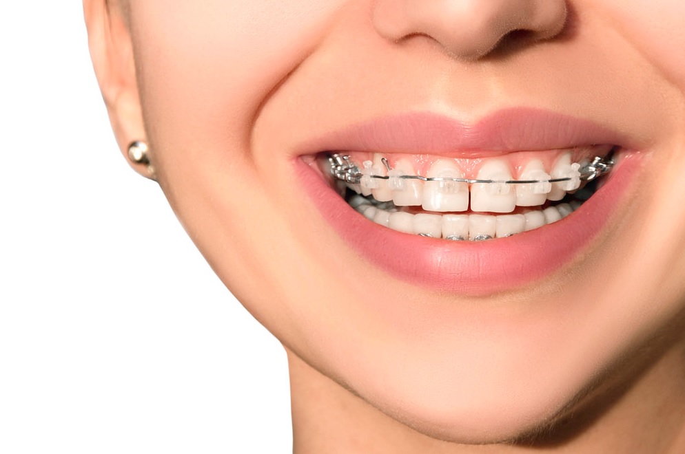 best orthodontist parramatta