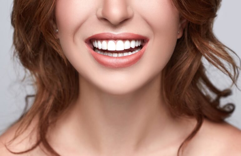 Porcelain Veneers Sydney