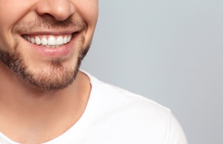 teeth cleaning cost Parramatta