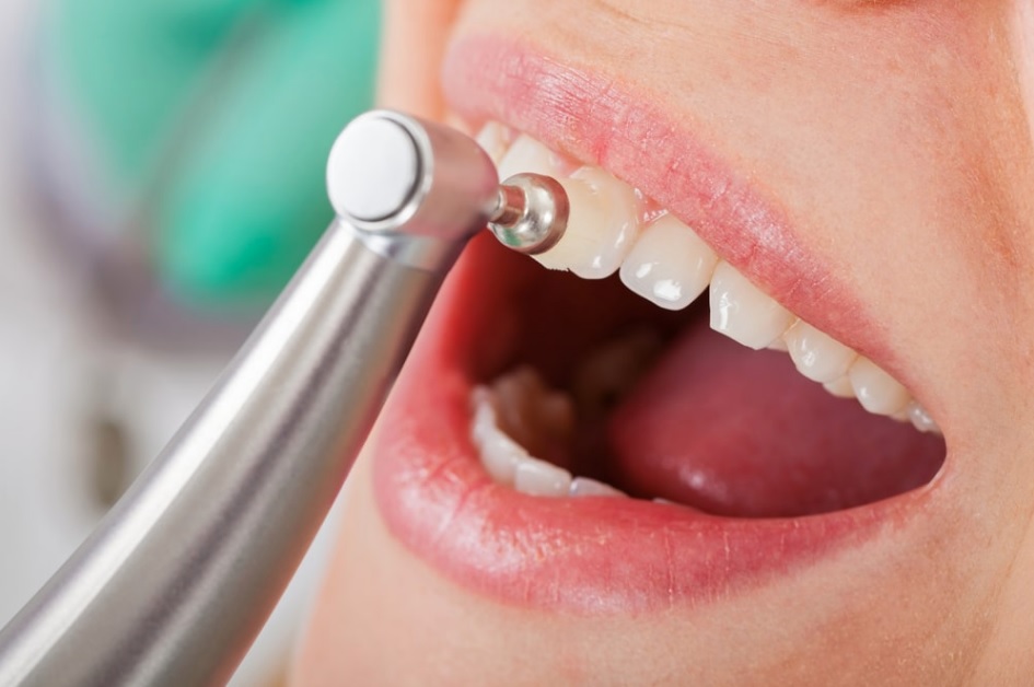 Cost Of Dental Exam And Cleaning Without Insurance