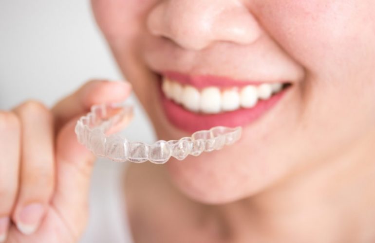 Invisalign Sydney