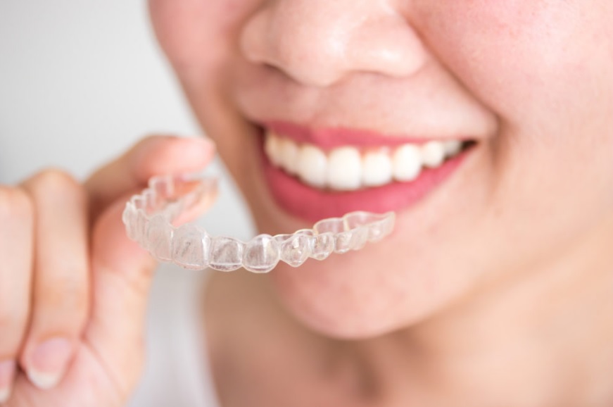 Invisalign Sydney