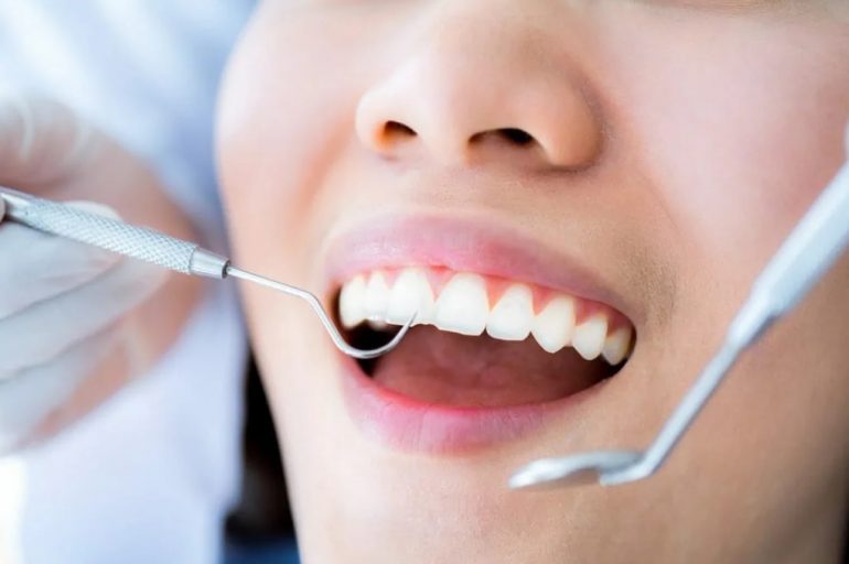 Teeth Cleaning Sydney | Parramatta Dentistry
