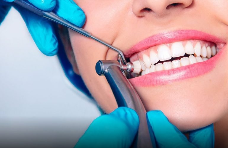 Dental Cleaning Cost