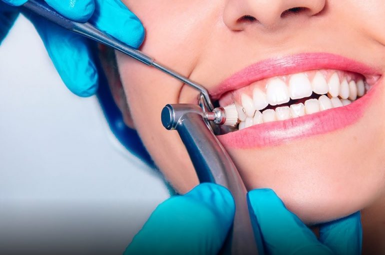 Dental Cleaning Cost Parramatta Dentistry