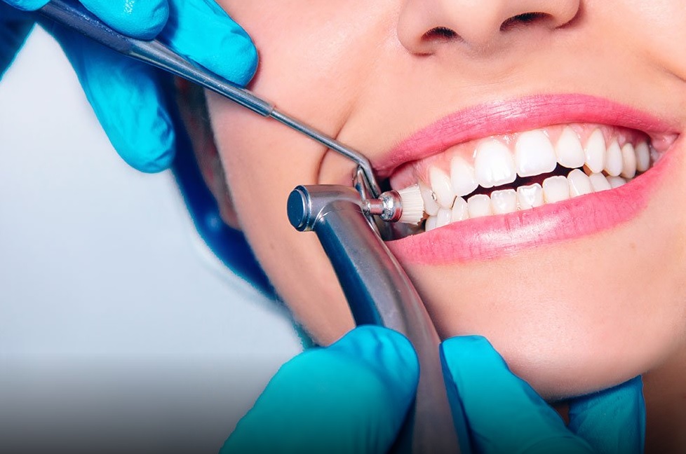 Dental Cleaning Cost