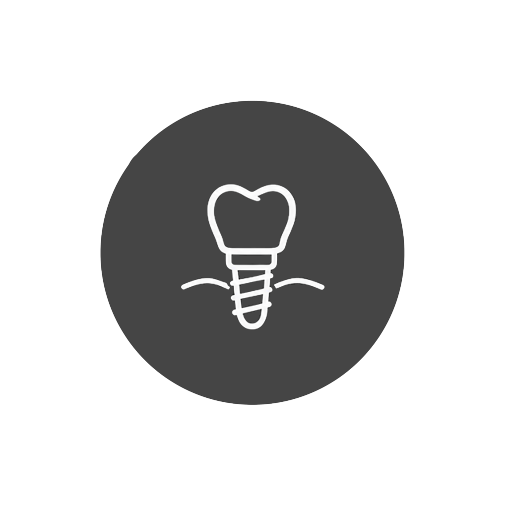 Diagram of dental implants replacing missing teeth