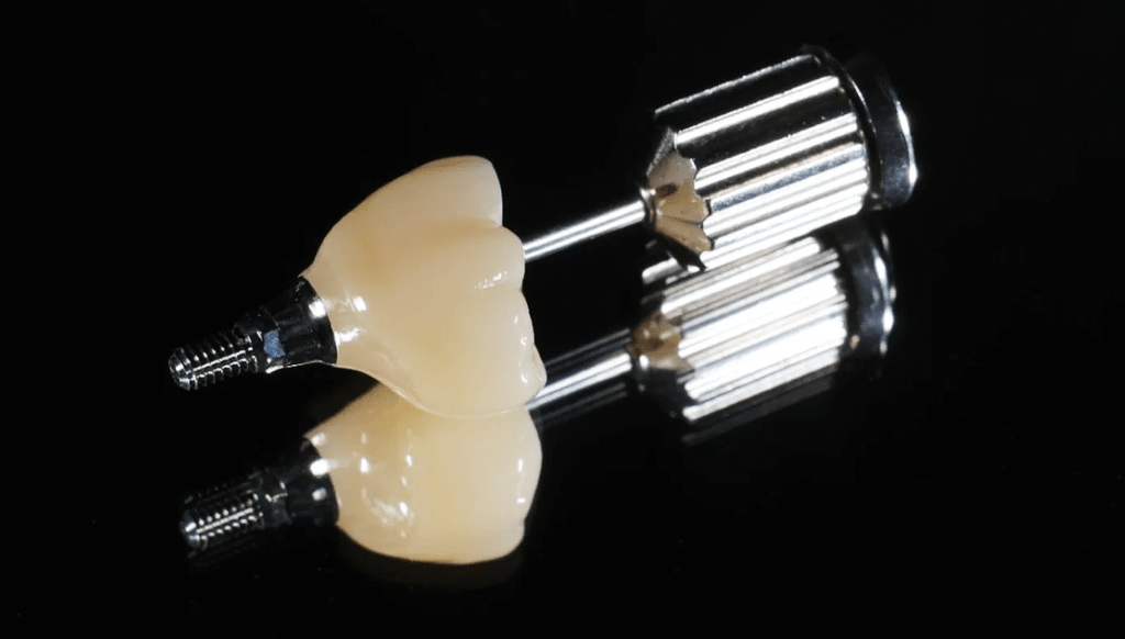 Dental implant abutment and crown