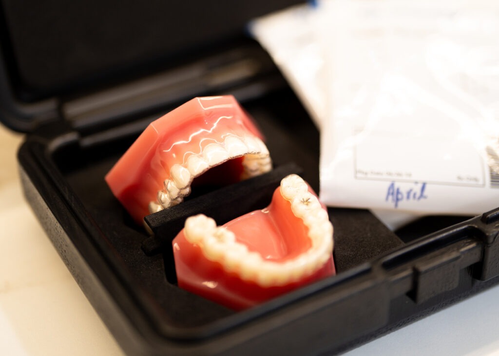 Invisalign available at Parramatta Dentistry