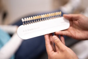 Teeth whitening treatment in Parramatta