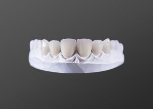Dental Veneers Package