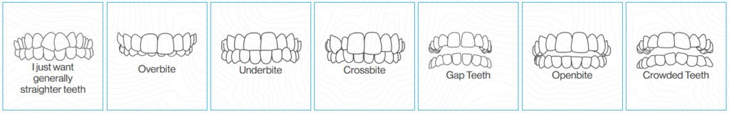 Issues Invisalign can fix